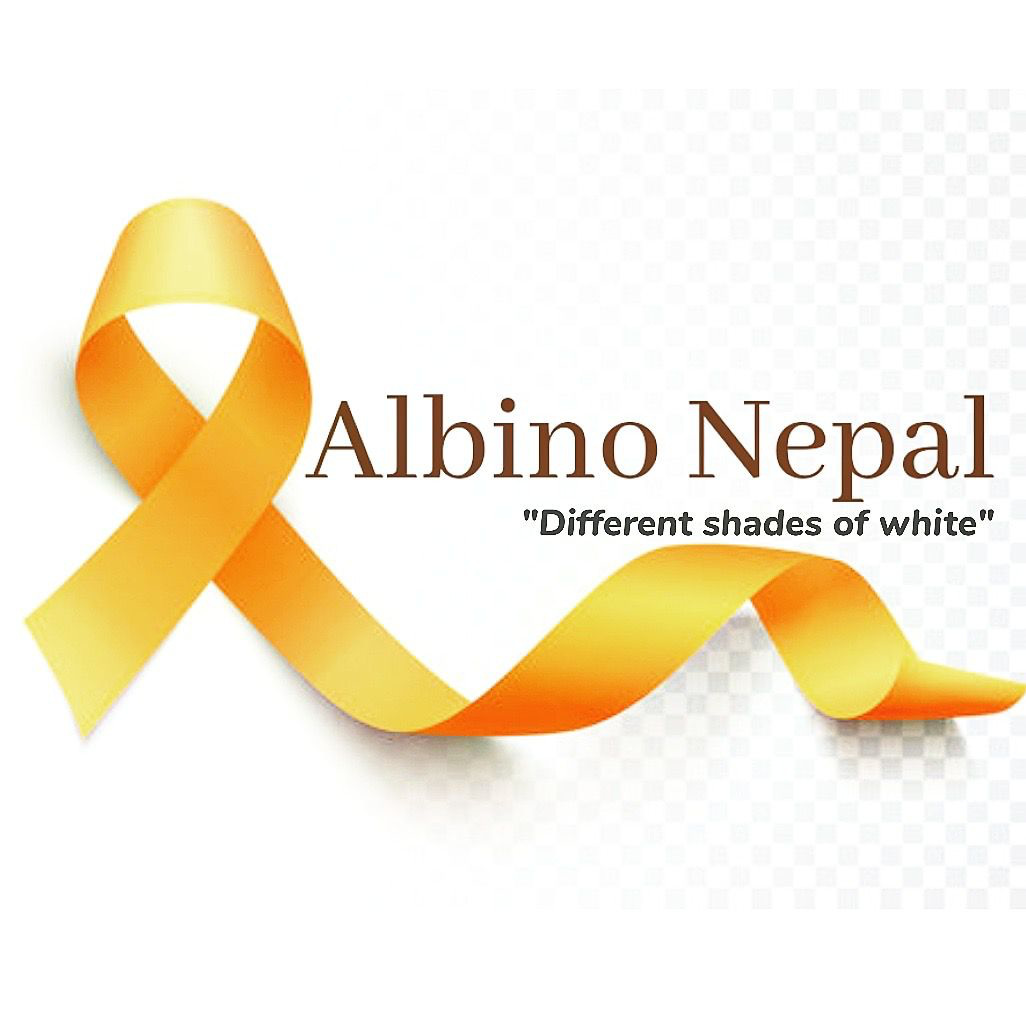 Albino Nepal